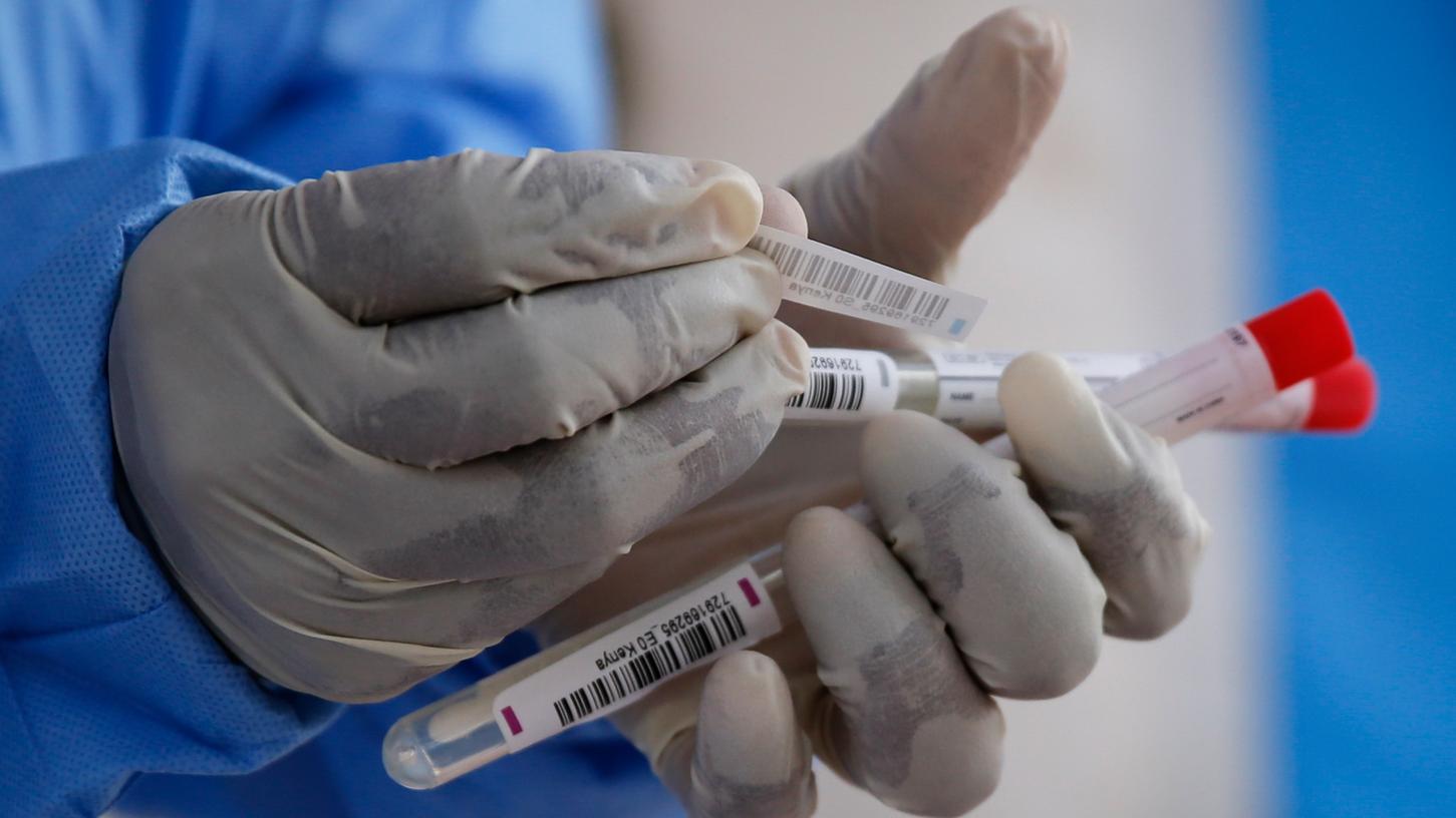 Die Wissenschaftler verfolgten das Auftreten von Virusmutationen und -varianten ab dem Beginn der Pandemie in zehn Ländern.
Die Wissenschaftler verfolgten das Auftreten von Virusmutationen und -varianten ab dem Beginn der Pandemie in zehn Ländern.