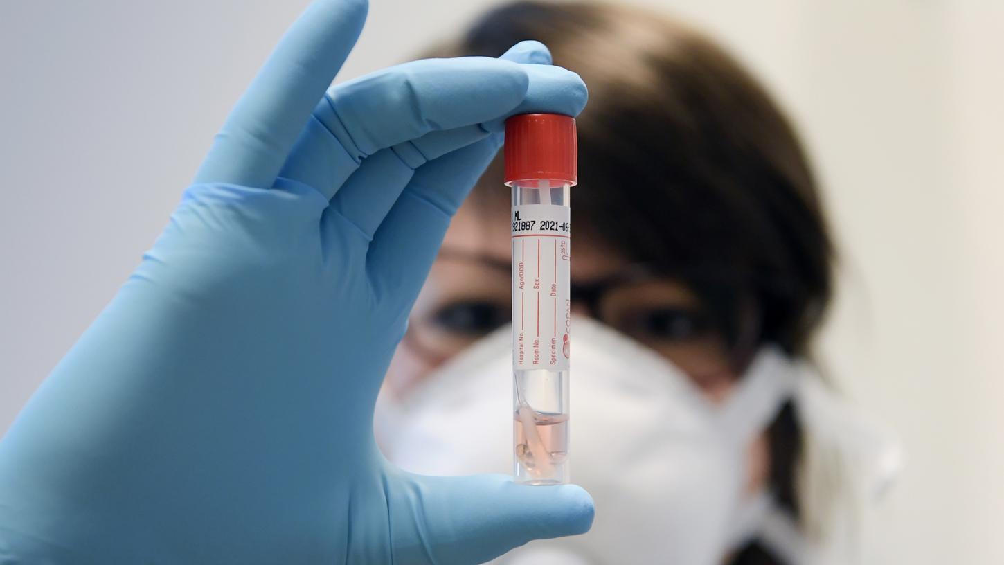 Ein Impfstoff ist noch nicht in Sicht, aber die Hoffnung auf eine dauerhafte Wirkung steigt wieder. Und beim Thema Corona-Tests geht Bayern in die Offensive - was aber für viel Kritik sorgt.