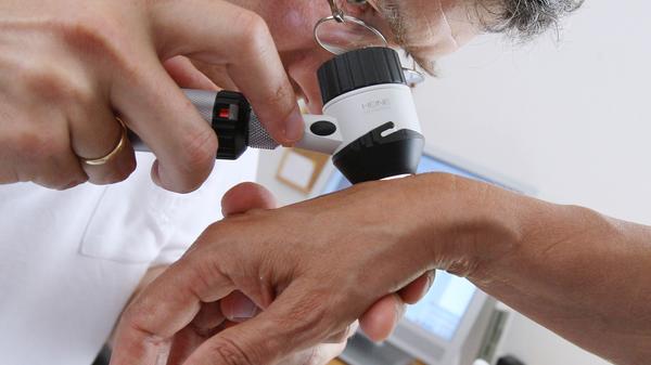 Trotz Sonnenschutz sollte man regelmäßig zum Hautarzt gehen und eine Hautkrebsvorsorge machen lassen. Nur der Arzt kann gefährliche Veränderungen an der Haut sicher diagnostizieren.
