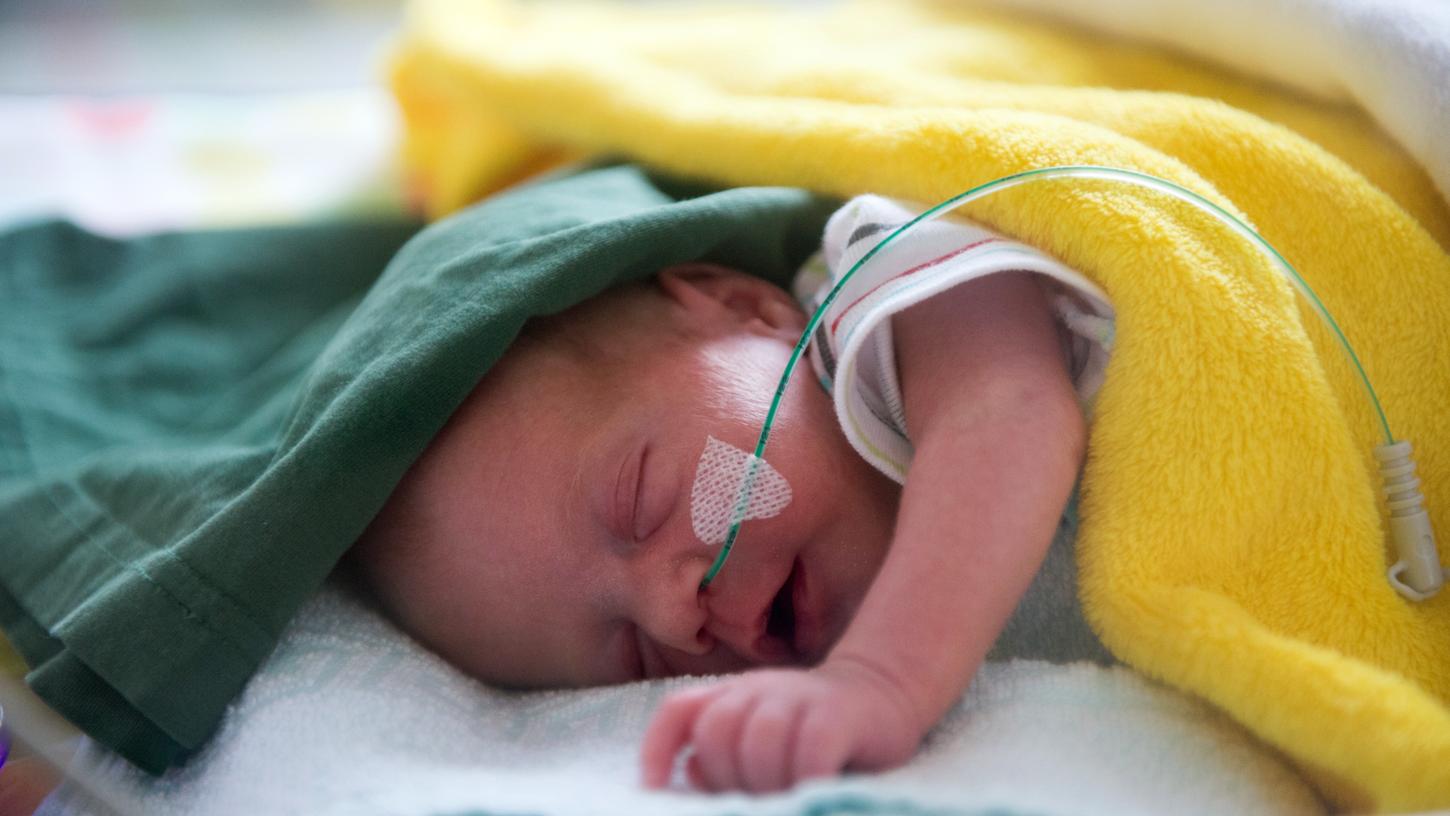 Viele Frühgeborene starten mit gesundheitlichen Schwierigkeiten ins Leben. Ein Forschungsprojekt des Klinikums Nürnberg soll zukünftig helfen. 
