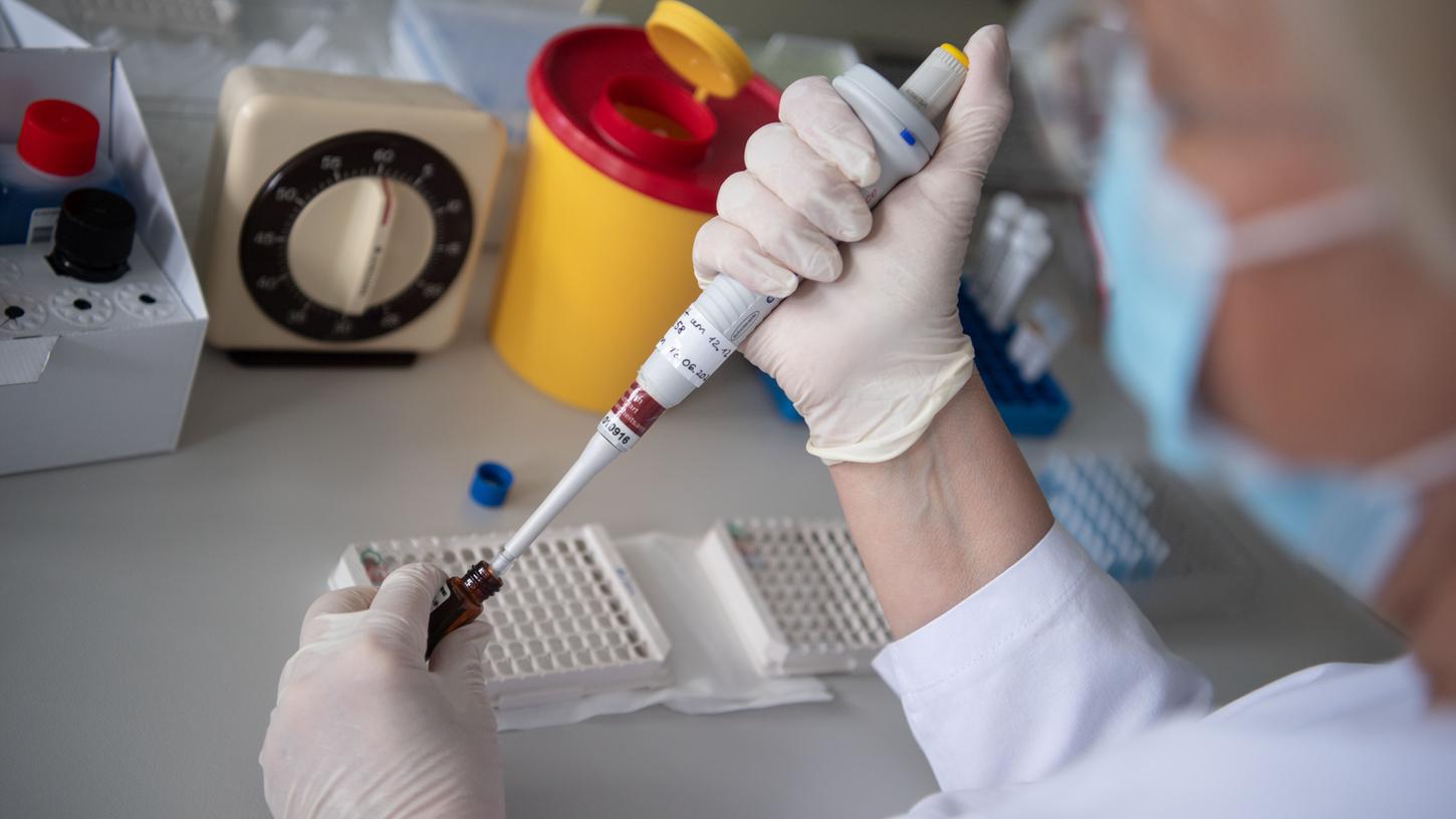 Um neutralisierende Antikörper im Blut nachzuweisen, sind aufwändige und teure Labortests erforderlich. Ein allgemeinter Antikörperwert könnte Abhilfe schaffen, doch wo soll dieser liegen?
