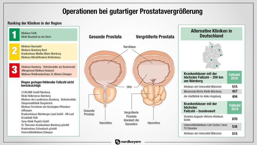 Prostata-Probleme: Wenn Männer ständig zur Toilette müssen