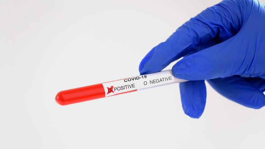 Bund und Länder wollen daran arbeiten, dass insgesamt die Testkapazitäten ausgebaut und damit mehr Coronavirus-Tests möglich werden.