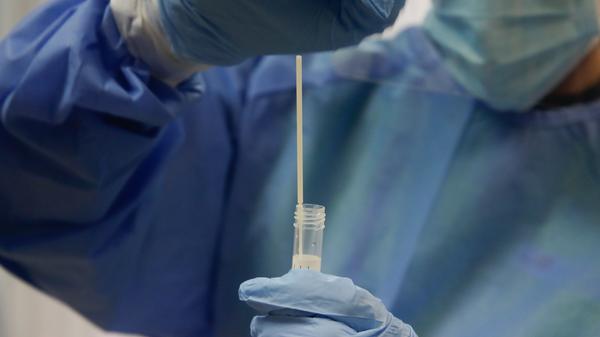 Am 29. September 2020 gibt die WHO einen traurigen Rekord bekannt: Weltweit sind inzwischen mehr als eine Million Menschen an oder mit dem Coronavirus gestorben.