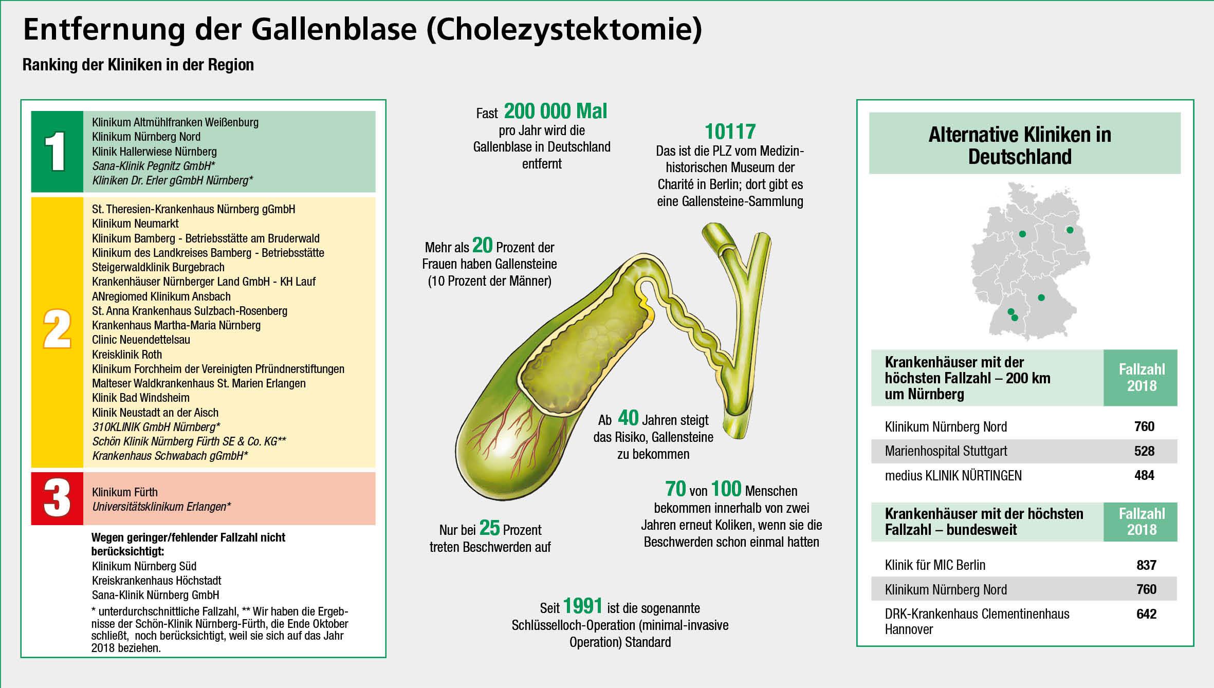 Probleme mit der Galle Diese Krankenhäuser helfen Nürnberg, Weißenburg nordbayern.de