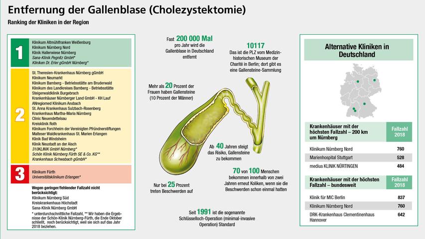 Unsere Übersicht zeigt, wie die Krankenhäuser im Großraum Nürnberg bei der Gallenblasen-OP bei den Qualitätsmessungen abschneiden. Um die Grafik in voller Auflösung zu sehen, klicken Sie bitte hier.