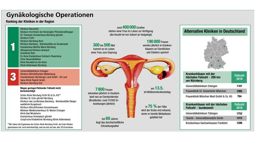 13 Krankenhäuser im nordbayerischen Raum zeigen in der Auswertung der Qualitätsdaten sehr gute Ergebnisse bei Operationen an Eierstöcken und Eileitern. Um die Infografik in voller Auflösung zu sehen, klicken Sie hier.
