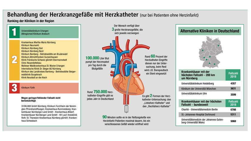 Das Universitätsklinikum Erlangen und das Anregiomed-Klinikum Ansbach zeigen in der Auswertung der Qualitätsdaten sehr gute Ergebnisse bei Herzkatheter-Eingriffen. Um die Infografik in voller Auflösung zu sehen, klicken Sie hier.
Das Universitätsklinikum Erlangen und das Anregiomed-Klinikum Ansbach zeigen in der Auswertung der Qualitätsdaten sehr gute Ergebnisse bei Herzkatheter-Eingriffen. Um die Infografik in voller Auflösung zu sehen, klicken Sie hier.