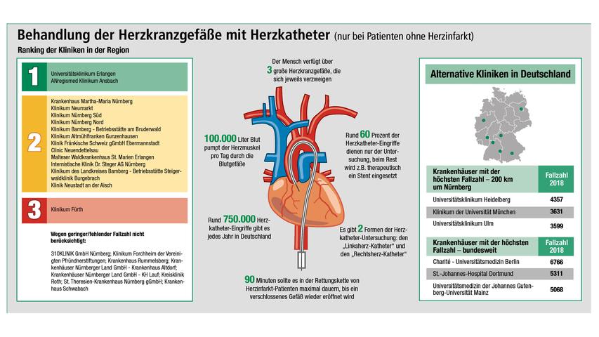 Das Universitätsklinikum Erlangen und das Anregiomed-Klinikum Ansbach zeigen in der Auswertung der Qualitätsdaten sehr gute Ergebnisse bei Herzkatheter-Eingriffen. Um die Infografik in voller Auflösung zu sehen, klicken Sie hier.