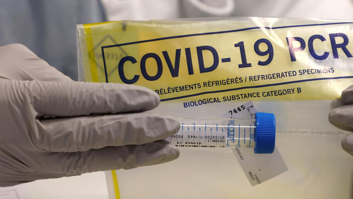 Zuletzt wurden in deutschen Laboren mittels PCR-Test mehr als 1,4 Millionen Abstriche auf Spuren des Coronavirus untersucht.