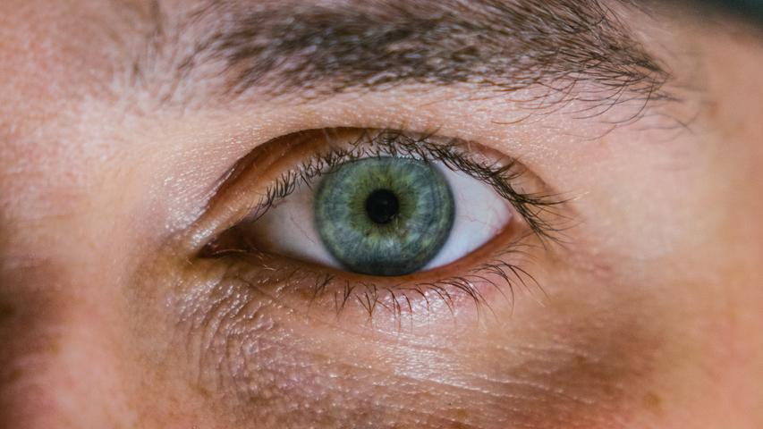 Auch Augen- und Schleimhautentzündungen können zu den Symptomen einer Corona-Infektion gehören.