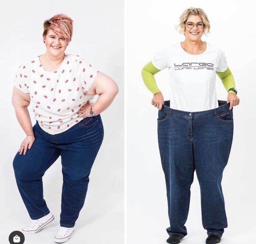 Chronische Krankheit Lipodem Junge Forchheimerin Hat Uber 70 Kilo Abgenommen Nordbayern