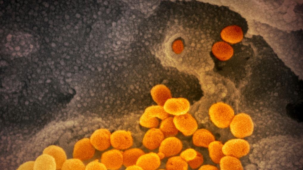 Eine elektronenmikroskopische Aufnahme des US. National Institute of Health zeigt das Coronavirus, das aus der Oberfläche von im Labor kultivierten Zellen austritt.