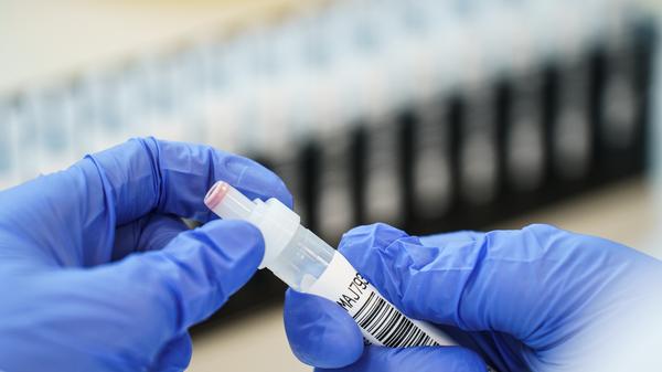 Coronavirus - Suche nach britischer Corona-Mutante