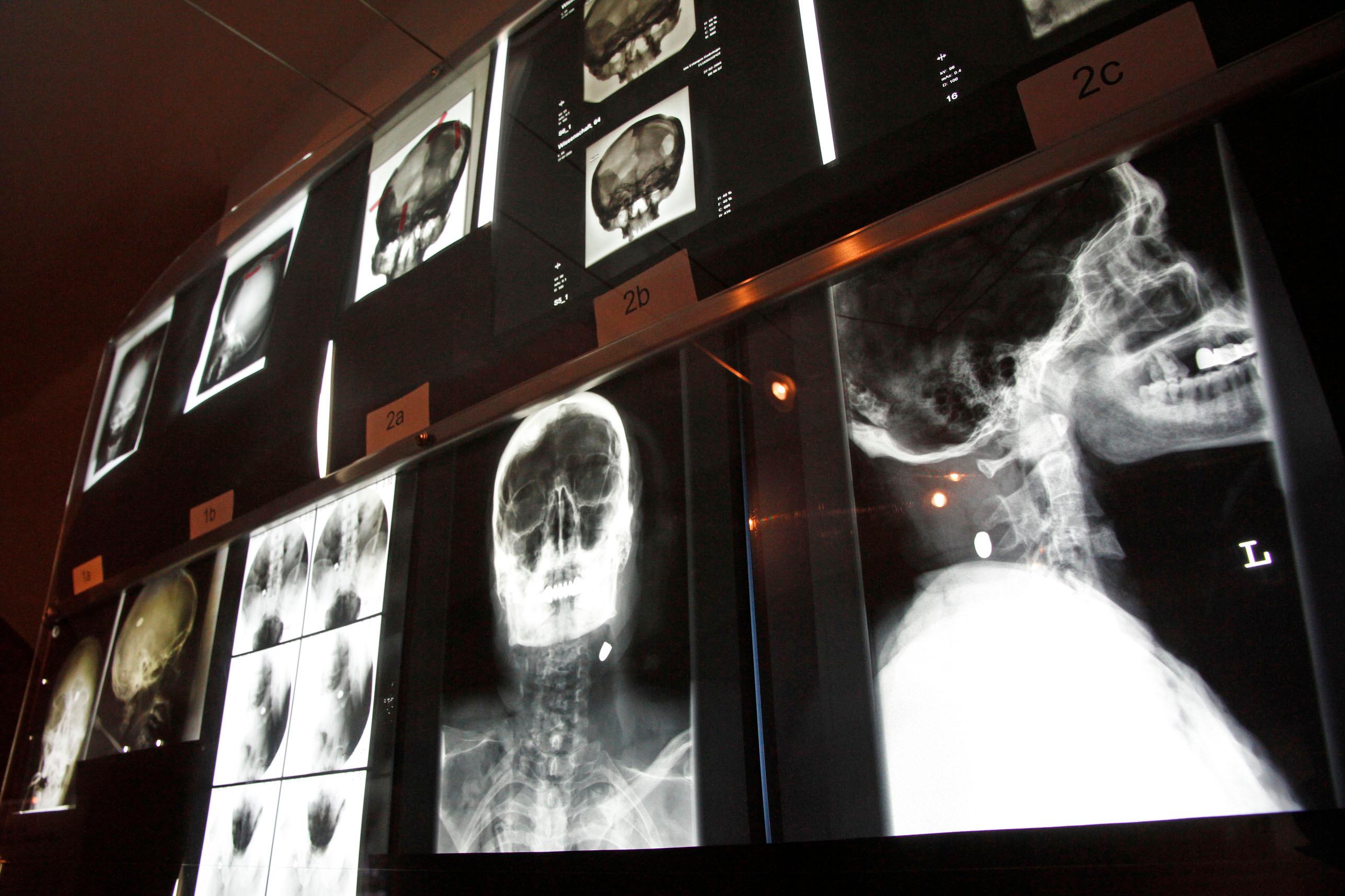 Neben der Fürther Polizei- und Justizgeschichte geht es hier auch um polizeiliche Ermittlungsarbeit.  