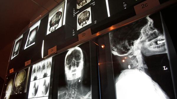 Neben der Fürther Polizei- und Justizgeschichte geht es hier auch um polizeiliche Ermittlungsarbeit.