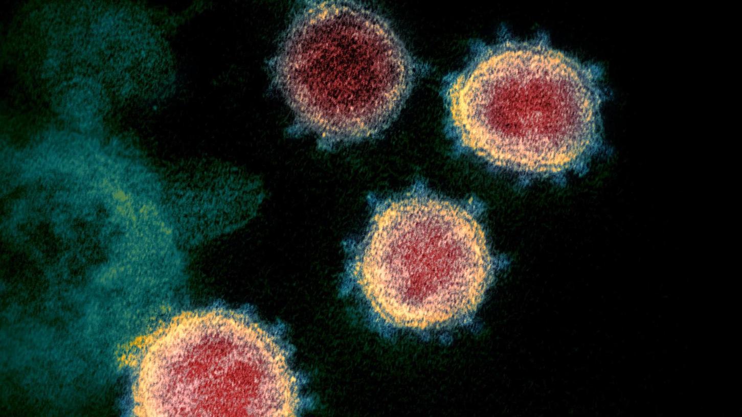 So sieht das Coronavirus Sars-Cov-2 unter dem Elektronenmikroskop aus. Auch die Erlanger Partnerstädte und -regionen leiden unter der Pandemie. 