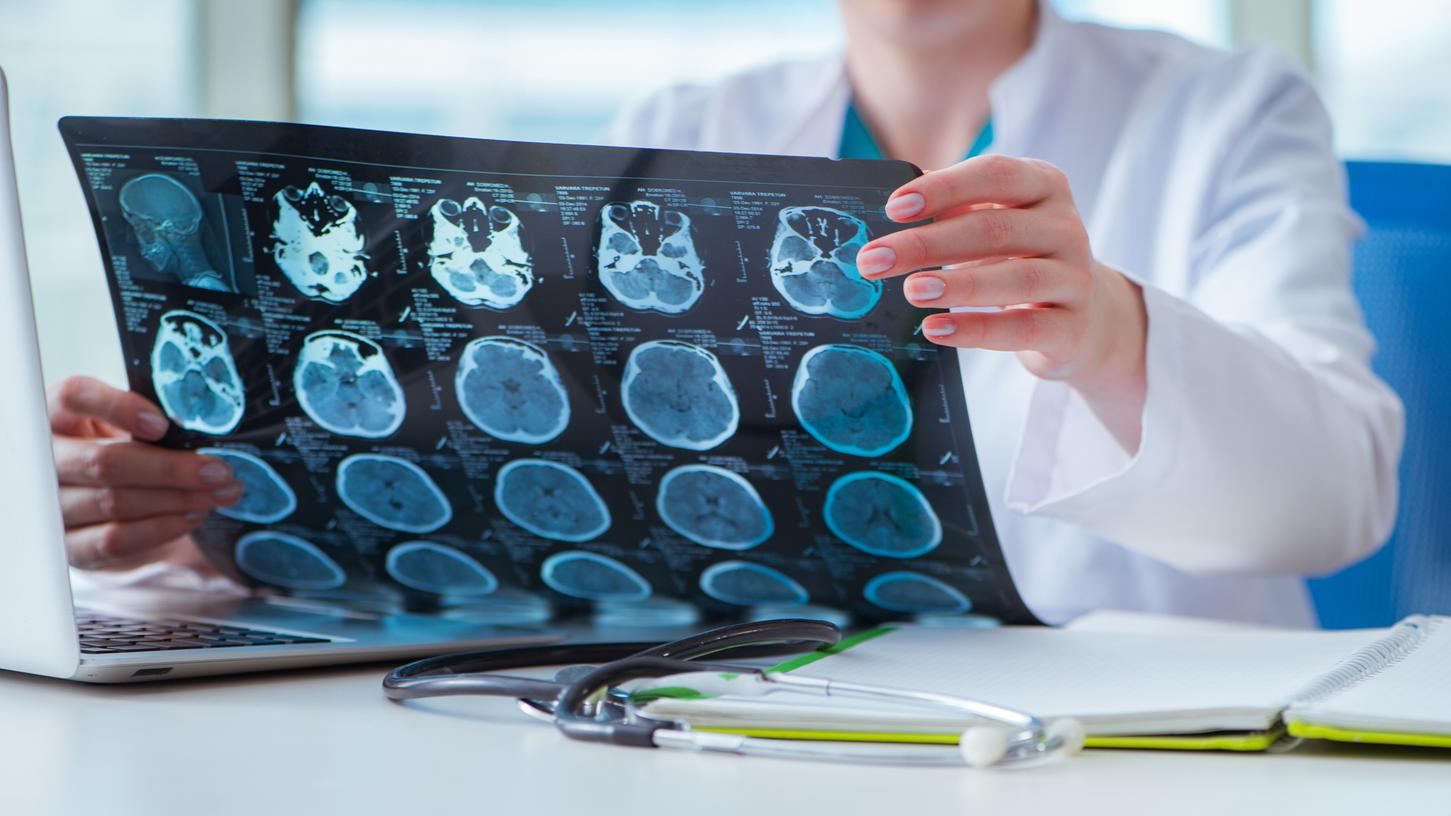 Eine Medizinerin begutachtet MRT-Aufnahmen des Gehirns. Bei einem Schlaganfall wird die Durchblutung von Gehirngewebe gestört, mit teils drastischen Langzeitfolgen.