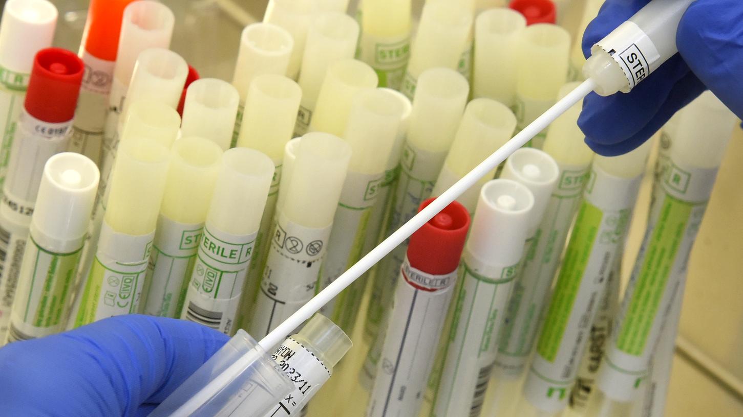 PCR-Tests werden im Labor analysiert - das braucht Zeit. PCR-Tests werden im Labor analysiert - das braucht Zeit.