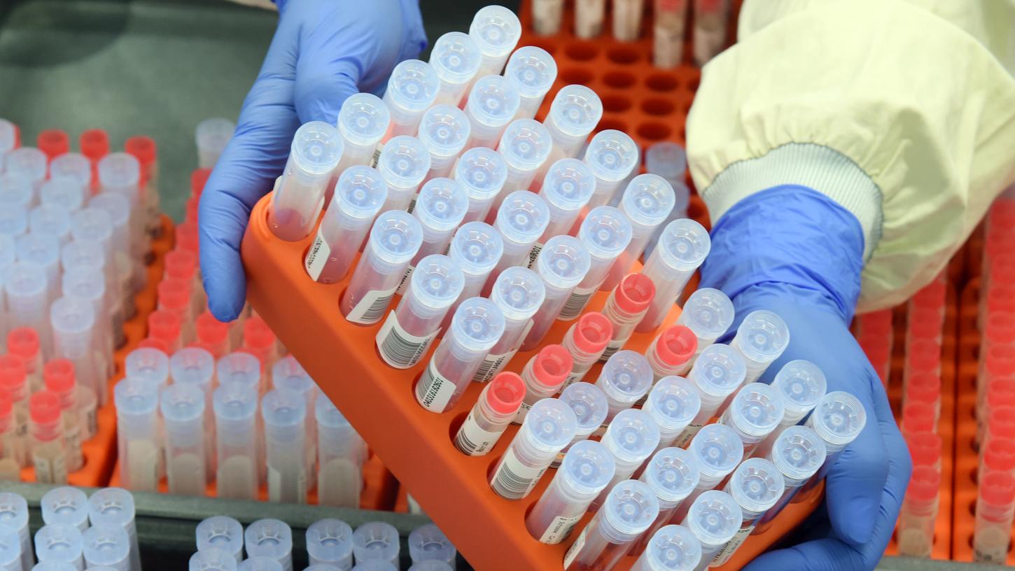 Im Labor wird mittels PCR-Test entnommenes Virusmaterial untersucht.