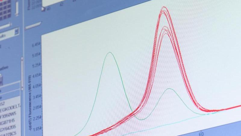 Neue Studie: Lässt sich mit dieser Methode das Coronavirus stoppen? Neue Studie: Lässt sich mit dieser Methode das Coronavirus stoppen?
