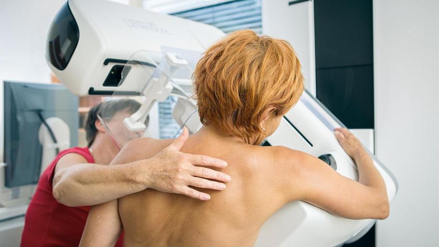 Eine Mammographie, also eine Röntgen-Untersuchung der Brust, steht Frauen im Alter von 50 bis 69 alle zwei Jahre im Rahmen des Brustkrebs-Screenings zu. 
