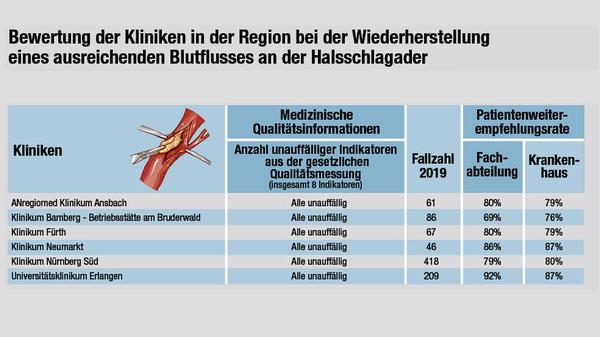 Klinikcheck Halsschlagader