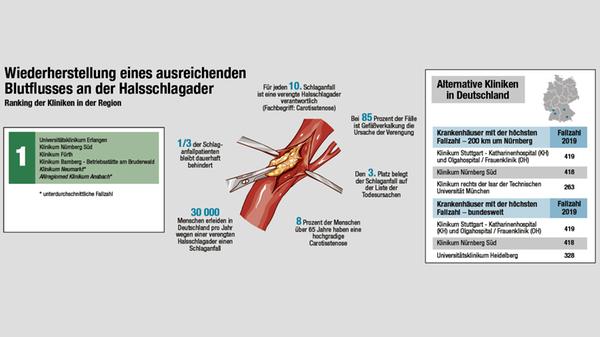 Ranking Halsschlagader Klinikcheck