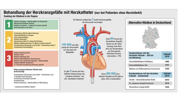 Herzkatheder-PCI-ohne Infarkt-ranking_2007.jpg
