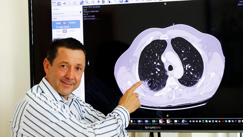 Professor Hubert Peter Grewe, Chefarzt der Medizinischen Klinik I am Klinikum Neumarkt, zeigt die Computertomographie-Aufnahme einer erkrankten Lunge. 