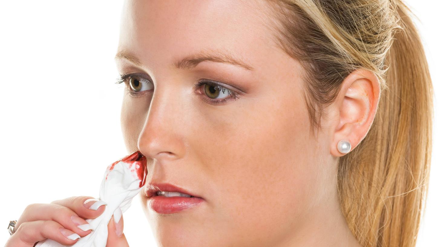 Nasenbluten kann eine Folge von Vitamin-K-Mangel sein. 