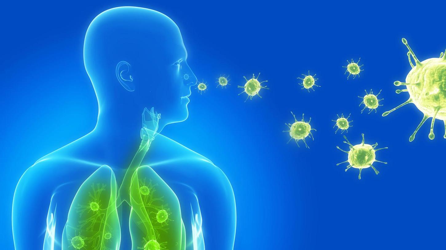 Vor allem Bakterien, aber auch Viren, die bei Covid-19 und der Influenza die Erkrankung auslösen, können in die kleinsten Lungenbläschen eindringen und eine schwere Lungenentzündung verursachen. 
