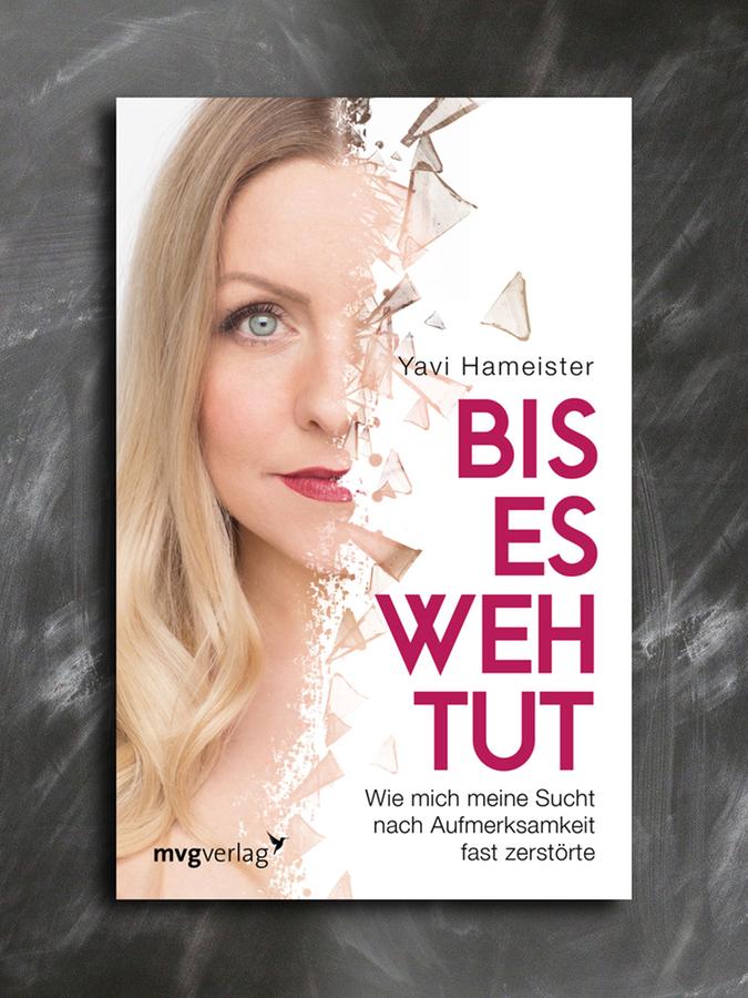 Yavi Hameister: Bis es wehtut. Wie mich meine Sucht nach Aufmerksamkeit fast zerstörte. Taschenbuch 16,99 Euro.