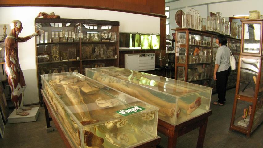Im Siriraj Medical Museum in Bangkok, Thailand, werden in Glasbehältern konservierte Leichen und Körperschnitte durch den Menschen gezeigt, ebenso wie in Alkohol eingelegte Organe.