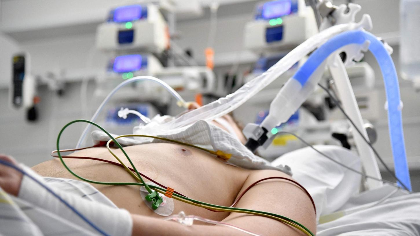 Die Zahl der Intensiv-Patienten mit Covid-19 im Klinikum Nürnberg steigt und steigt. Jetzt ziehen die Verantwortlichen die Notbremse.
Die Zahl der Intensiv-Patienten mit Covid-19 im Klinikum Nürnberg steigt und steigt. Jetzt ziehen die Verantwortlichen die Notbremse.
