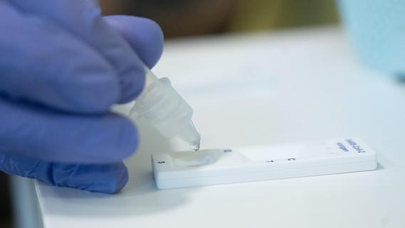 Wo gibt es PCR- und Schnelltests in Fürth? Ein Überblick