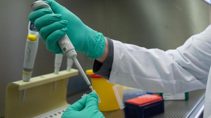 Woche für Woche werden in Bayern Hunderttausende PCR-Tests gemacht. Oft fehlt bei Infizierten aber der Impfstatus. 