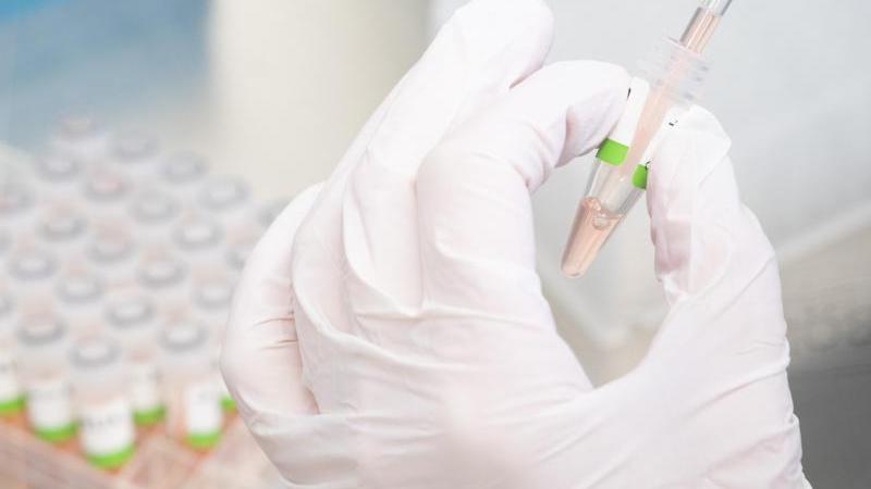 Die Omikron-Variante hat in Tschechien inzwischen einen Anteil von mehr als 80 Prozent an den auf Varianten untersuchten Proben.
Die Omikron-Variante hat in Tschechien inzwischen einen Anteil von mehr als 80 Prozent an den auf Varianten untersuchten Proben.
