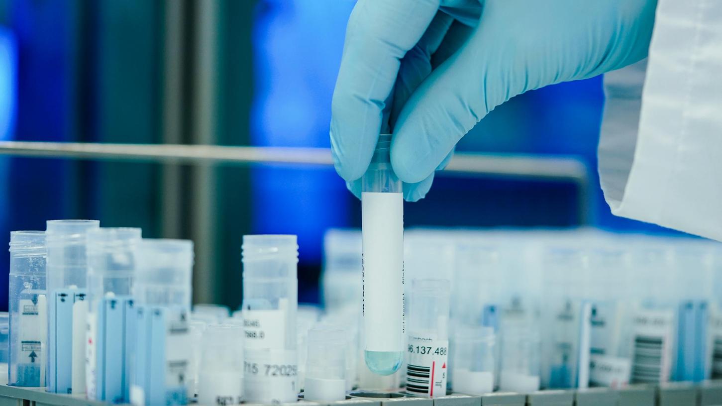 PCR-Tests: Freie Termine in Testzentren - doch das könnte sich bald ändern