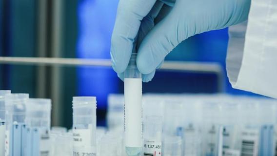 PCR-Tests: Das ändert sich am Donnerstag in Bayern