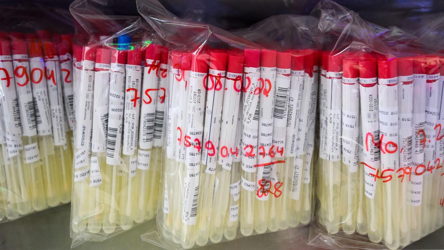 Künftig sollen die Kapazitäten von PCR-Tests gezielter genutzt werden.