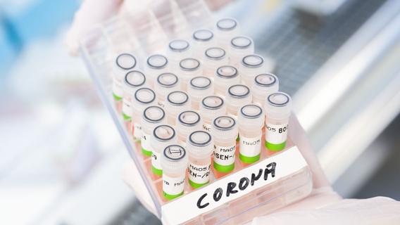 Übersicht: Wer bekommt noch einen kostenlosen PCR-Test in Bayern?