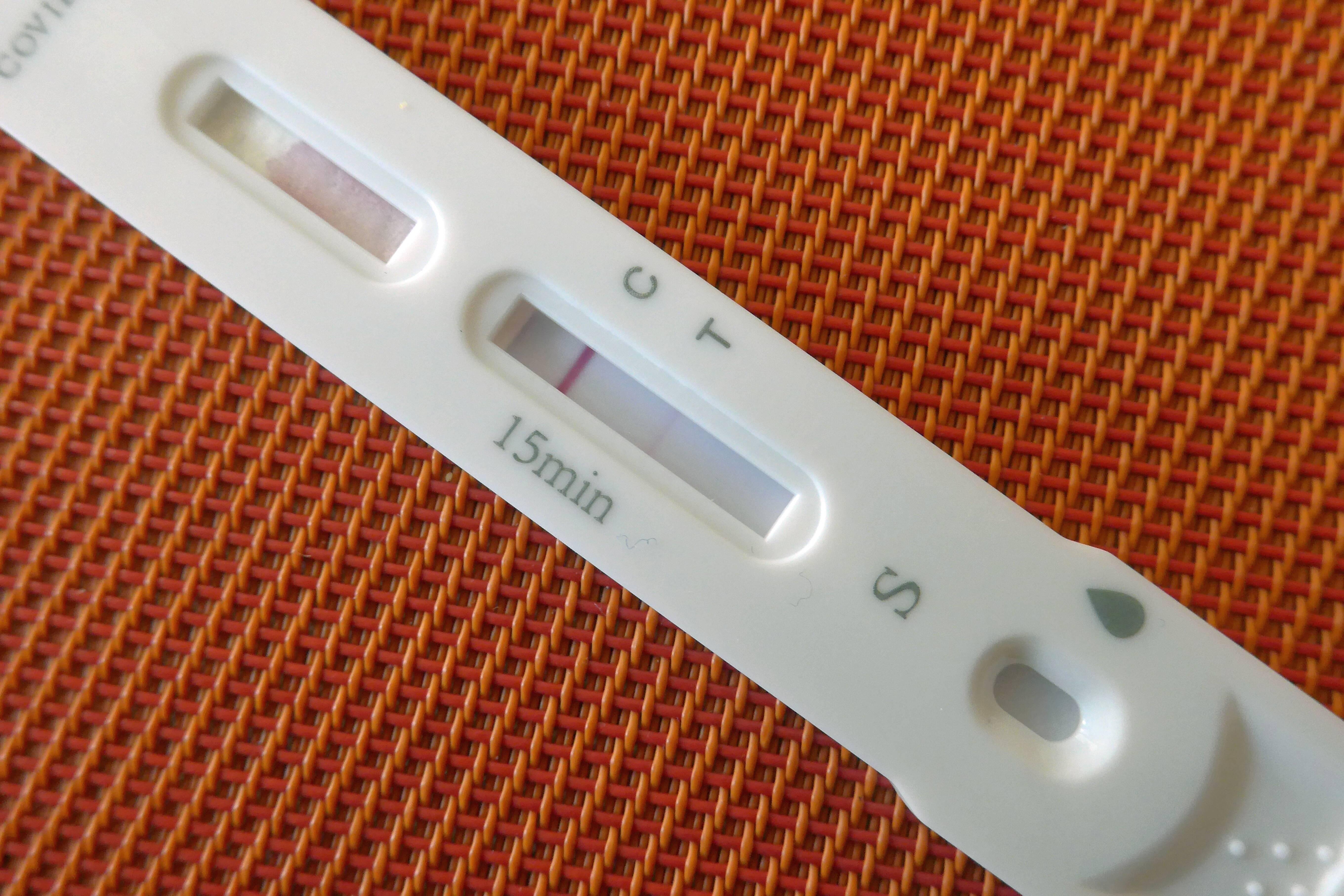 Corona Test: Zwei Striche – Was bedeutet das und was nun? Dein Ratgeber