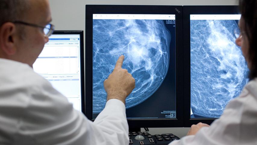 Welche zusätzlichen Maßnahmen können bei Brustkrebs noch helfen? Drei Experten des Erlanger Uni-Klinikums beantworten bei einer Telefonaktion am 27. April 2022 dazu Fragen (Symbolbild). 