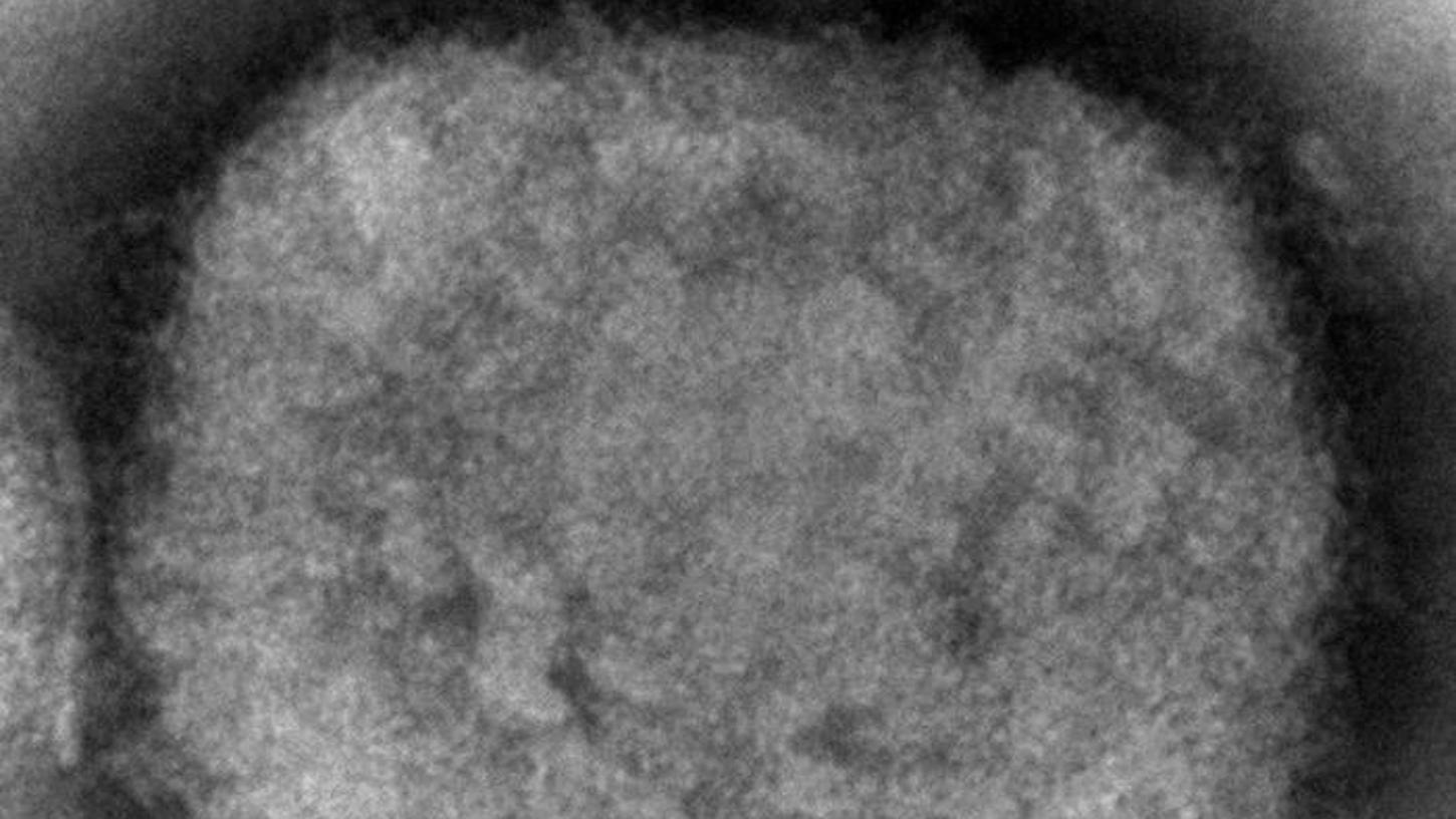 Der nächste Virus nach Corona? So gefährlich sind Affenpocken Der nächste Virus nach Corona? So gefährlich sind Affenpocken