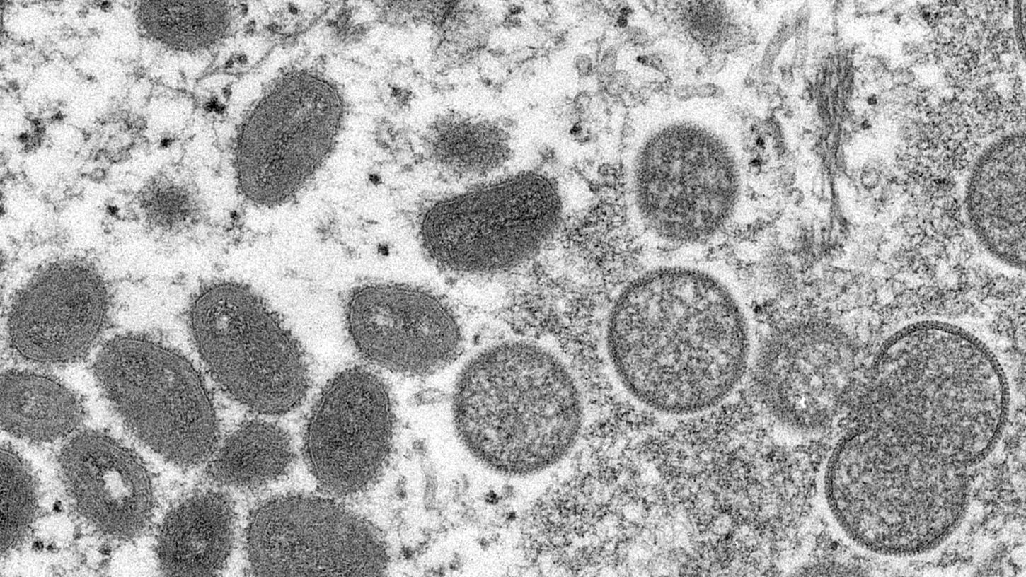 Diese elektronenmikroskopische Aufnahme zeigt reife, ovale Affenpockenviren (l) und kugelförmige unreife Virionen (r), die aus einer menschlichen Hautprobe stammen.
