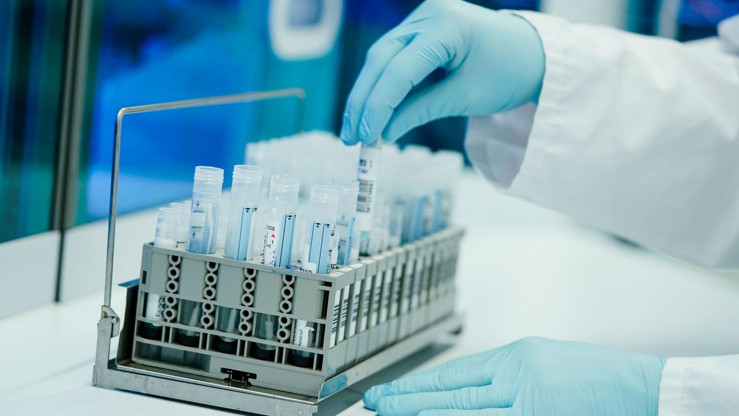 Ein Mitarbeiter eines Heidelberger Coronatest-Labors bereitet PCR-Teströhrchen vor. Ein Mitarbeiter eines Heidelberger Coronatest-Labors bereitet PCR-Teströhrchen vor.