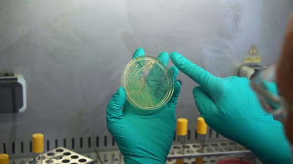 In Oberschleißheim betreibt das Landesamt für Gesundheit und Lebensmittelsicherheit (LGL) eines der sichersten Labore im Freistaat. Dort wird mit Milzbrand, HIV und Tuberkulose-Bakterien gearbeitet. In der hauseigenen Sammlung des Schreckens im Keller der Anlage werden bis zu 150 Erreger tiefgekühlt aufbewahrt. Erst dann, wenn sie für die Forschung gebraucht werden, tauen die Experten sie auf.