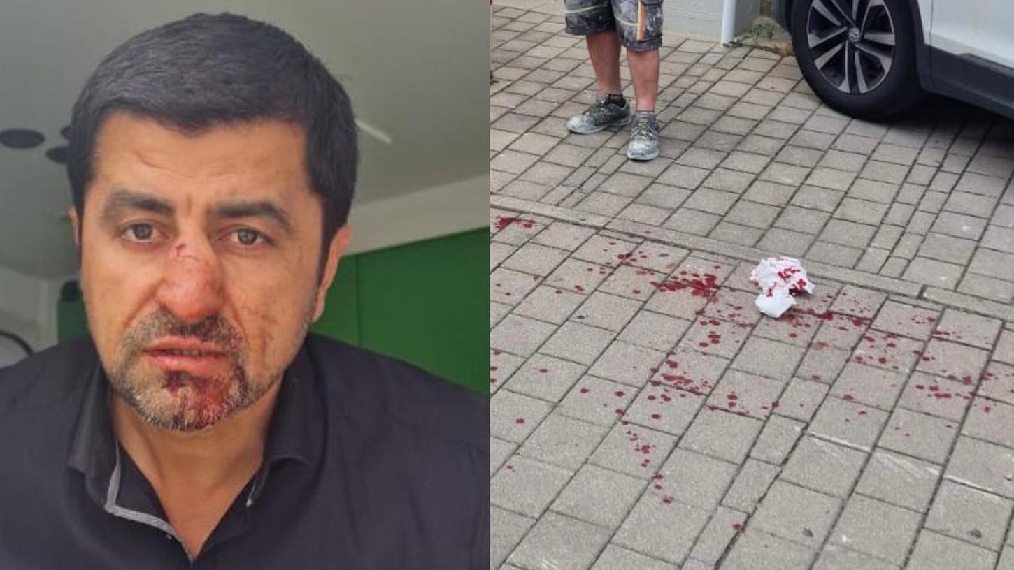 Der Bayreuther SPD-Politiker Halil Taşdelen erlitt bei dem Angriff einen doppelten Nasenbeinbruch. 
