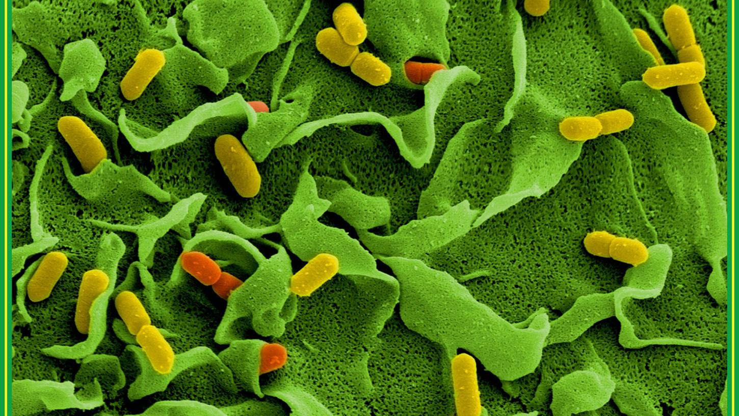 Elektronenmikroskopische Aufnahmen von Listerien (Listeria monocytogenes). Ein bayerisches Unternehmen ruft ihr Produkt "Bavaria blu Der Würzige 300g" zurück. Elektronenmikroskopische Aufnahmen von Listerien (Listeria monocytogenes). Ein bayerisches Unternehmen ruft ihr Produkt "Bavaria blu Der Würzige 300g" zurück.